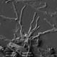 Una imagen de microscopio electrónico de barrido que muestra lo que parecen ser axones parecidos a gusanos que sobresalen de las células neuronales.